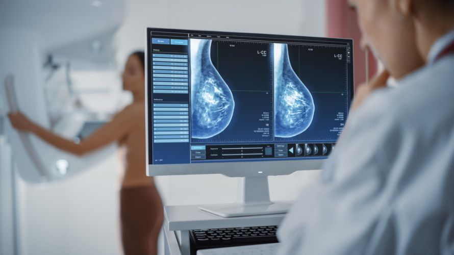 Mammographie bei Galaktorrhoe